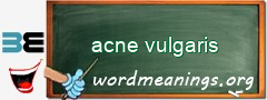 WordMeaning blackboard for acne vulgaris